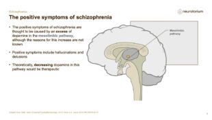 Schizophrenia – Neurobiology and Aetiology – slide 24